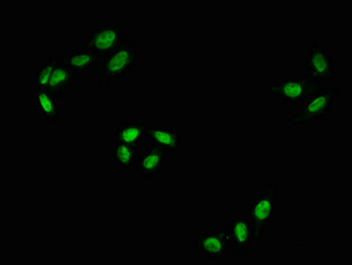 Immunofluorescence staining of Hela with RAC07643 at 1:100,counter-stained with DAPI. The cells were fixed in 4% formaldehyde, permeabilized using 0.2% Triton X-100 and blocked in 10% normal Goat Serum. The cells were then incubated with the antibody overnight at 4?. The secondary antibody was Alexa Fluor 488-congugated AffiniPure Goat Anti-Rabbit IgG (H+L).