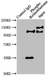 Immunoprecipitating Phospho-RB1 in Hela whole cell lysate; Lane 1: Rabbit control IgG(1ug)instead of RAC07644 in Hela whole cell lysate.For western blotting,a HRP-conjugated Protein G antibody was used as the secondary antibody (1/2000); Lane 2: RAC07644(3ug)+ Hela whole cell lysate(1mg); Lane 3: Hela whole cell lysate (20ug)
