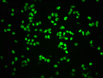 Immunofluorescence staining of K562 cells with RAC07645 at 1:100,counter-stained with DAPI. The cells were fixed in 4% formaldehyde, permeabilized using 0.2% Triton X-100 and blocked in 10% normal Goat Serum. The cells were then incubated with the antibody overnight at 4?. The secondary antibody was Alexa Fluor 488-congugated AffiniPure Goat Anti-Rabbit IgG (H+L).