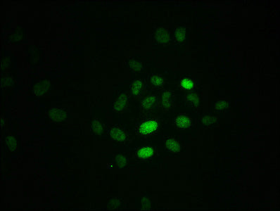 Immunofluorescence staining of Hela cells with RAC07646 at 1:100,counter-stained with DAPI. The cells were fixed in 4% formaldehyde, permeabilized using 0.2% Triton X-100 and blocked in 10% normal Goat Serum. The cells were then incubated with the antibody overnight at 4?. The secondary antibody was Alexa Fluor 488-congugated AffiniPure Goat Anti-Rabbit IgG (H+L).