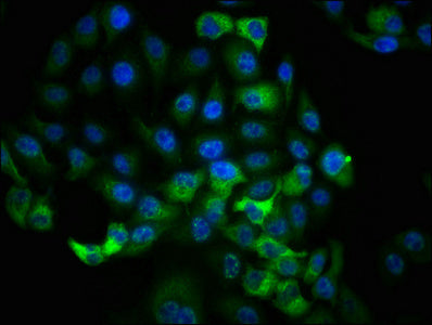 Immunofluorescence staining of Hela cells with RAC07648 at 1:100,counter-stained with DAPI. The cells were fixed in 4% formaldehyde, permeabilized using 0.2% Triton X-100 and blocked in 10% normal Goat Serum. The cells were then incubated with the antibody overnight at 4?. The secondary antibody was Alexa Fluor 488-congugated AffiniPure Goat Anti-Rabbit IgG (H+L).