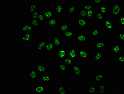 Immunofluorescence staining of Hela cells with RAC07650 at 1:100,counter-stained with DAPI. The cells were fixed in 4% formaldehyde, permeabilized using 0.2% Triton X-100 and blocked in 10% normal Goat Serum. The cells were then incubated with the antibody overnight at 4?. The secondary antibody was Alexa Fluor 488-congugated AffiniPure Goat Anti-Rabbit IgG (H+L).