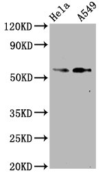 Western Blot; Positive WB detected in Hela whole cell lysate,A549 whole cell lysate; All lanes Phospho-SMAD2 antibody at 1.07ug/ml; Secondary; Goat polyclonal to rabbit IgG at 1/50000 dilution; Predicted band size: 58 KDa; Observed band size: 58 KDa