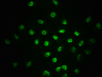 Immunofluorescence staining of A549 cells with RAC07652 at 1:100,counter-stained with DAPI. The cells were fixed in 4% formaldehyde, permeabilized using 0.2% Triton X-100 and blocked in 10% normal Goat Serum. The cells were then incubated with the antibody overnight at 4?. The secondary antibody was Alexa Fluor 488-congugated AffiniPure Goat Anti-Rabbit IgG (H+L).