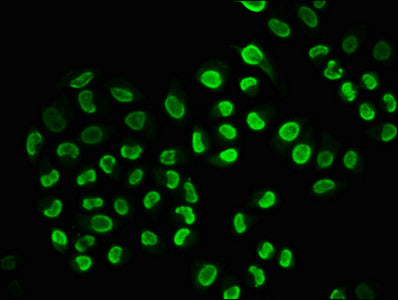 Immunofluorescence staining of Hela cells(treated with 100mM EGF for 20min) with RAC07656 at 1:206,counter-stained with DAPI. The cells were fixed in 4% formaldehyde, permeabilized using 0.2% Triton X-100 and blocked in 10% normal Goat Serum. The cells were then incubated with the antibody overnight at 4?. The secondary antibody was Alexa Fluor 488-congugated AffiniPure Goat Anti-Rabbit IgG (H+L).