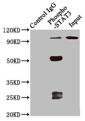Immunoprecipitating Phospho-STAT3 in 293 whole cell lysate treated with Calyculin A; Lane 1: Rabbit control IgG(1ug)instead of RAC07657 in 293 whole cell lysate treated with Calyculin A.For western blotting,a HRP-conjugated Protein G antibody was used as the secondary antibody (1/2000); Lane 2: RAC07657(3ug)+ 293 whole cell lysate treated with Calyculin A(1mg); Lane 3: 293 whole cell lysate treated with Calyculin A (20ug)