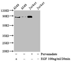 Western Blot; Positive WB detected in A549 whole cell lysate,Jurkat whole cell lysate(treated with EGF or Pervanadate); All lanes Phospho-STAT3 antibody at 0.925ug/ml; Secondary; Goat polyclonal to rabbit IgG at 1/50000 dilution; Predicted band size: 88 KDa; Observed band size: 88 KDa