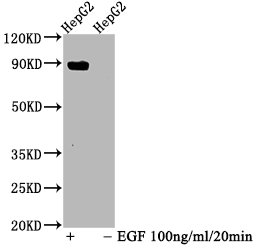 Western Blot; Positive WB detected in HepG2 whole cell lysate(treated with EGF or not); All lanes Phospho-STAT5A antibody at 1.025ug/ml; Secondary; Goat polyclonal to rabbit IgG at 1/50000 dilution; Predicted band size: 90 KDa; Observed band size: 90 KDa