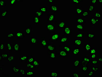Immunofluorescence staining of Hela cells with RAC07660 at 1:100,counter-stained with DAPI. The cells were fixed in 4% formaldehyde, permeabilized using 0.2% Triton X-100 and blocked in 10% normal Goat Serum. The cells were then incubated with the antibody overnight at 4?. The secondary antibody was Alexa Fluor 488-congugated AffiniPure Goat Anti-Rabbit IgG (H+L).