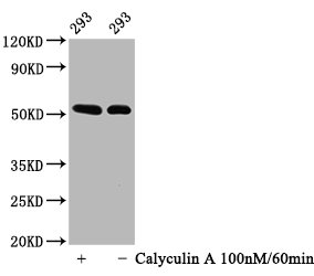 Western Blot; Positive WB detected in: 293 whole cell lysate(treated with Calyculin A or not); All lanes: Phospho-TP53 antibody at 0.64ug/ml; Secondary; Goat polyclonal to rabbit IgG at 1/50000 dilution; Predicted band size: 53 KDa; Observed band size: 53 KDa