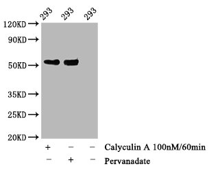 Western Blot; Positive WB detected in 293 whole cell lysate(treated with Calyculin A or Pervanadate); All lanes Phospho-TP53 antibody at 1.28ug/ml; Secondary; Goat polyclonal to rabbit IgG at 1/50000 dilution; Predicted band size: 53 KDa; Observed band size: 53 KDa