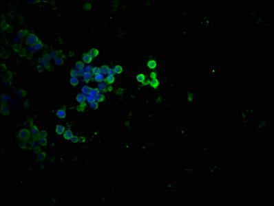Immunofluorescence staining of 293 cells(treated with 50mM Calyculin A for 30min) with RAC07663 at 1:100,counter-stained with DAPI. The cells were fixed in 4% formaldehyde, permeabilized using 0.2% Triton X-100 and blocked in 10% normal Goat Serum. The cells were then incubated with the antibody overnight at 4?. The secondary antibody was Alexa Fluor 488-congugated AffiniPure Goat Anti-Rabbit IgG (H+L).