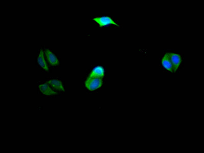 Immunofluorescence staining of Hela Cells with RAC07665 at 1:50, counter-stained with DAPI. The cells were fixed in 4% formaldehyde, permeated by 0.2% TritonX-100, and blocked in 10% normal Goat Serum. The cells were then incubated with the antibody overnight at 4?. Nuclear DNA was labeled in blue with DAPI. The secondary antibody was FITC-conjugated AffiniPure Goat Anti-Rabbit IgG (H+L).