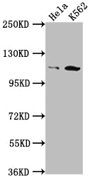 Western Blot; Positive WB detected in: Hela whole cell lysate, K562 whole cell lysate; All lanes: PIK3CB antibody at 1:1500; Secondary; Goat polyclonal to rabbit IgG at 1/50000 dilution; Predicted band size: 123 kDa; Observed band size: 110 kDa