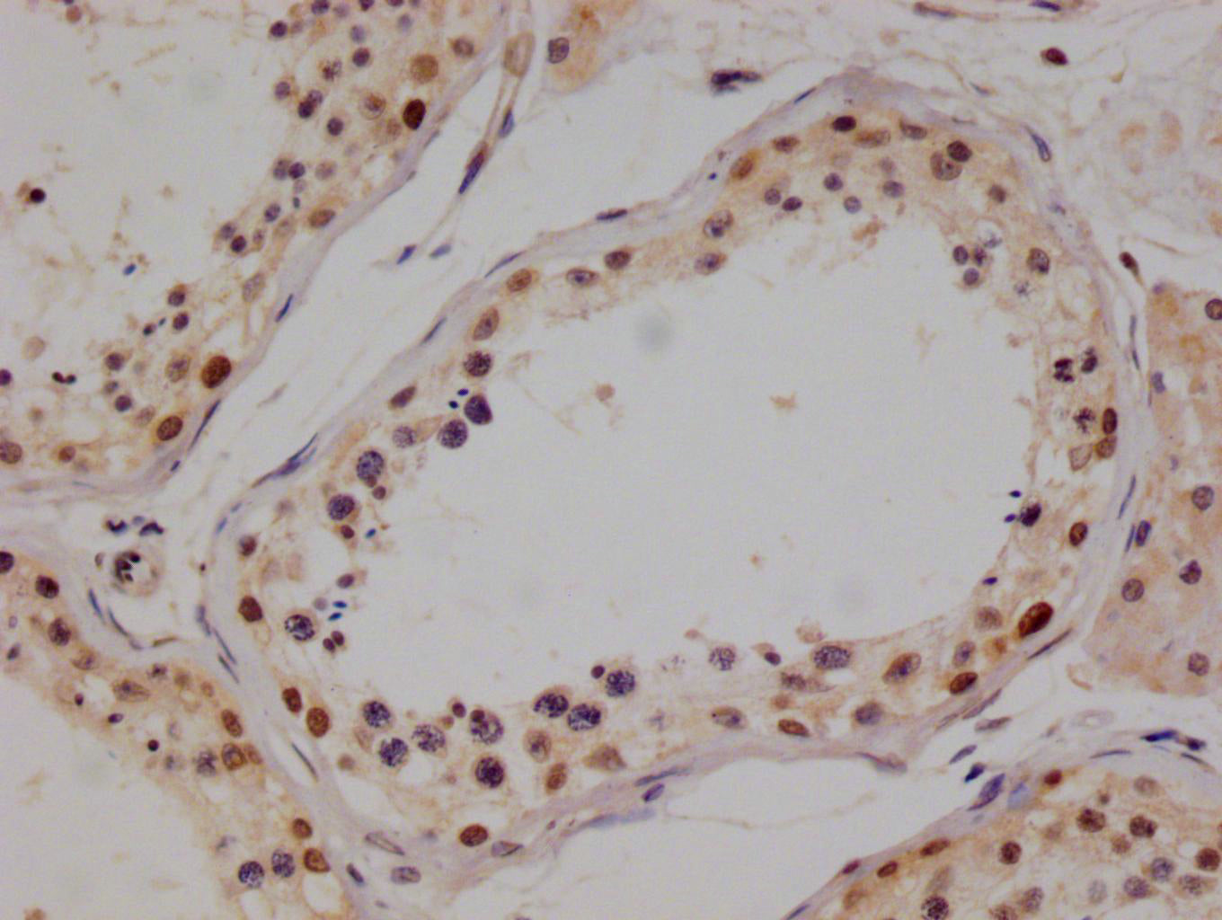 IHC image of RAC07668 diluted at 1:100 and staining in paraffin-embedded human testis tissue performed on a Leica BondTM system. After dewaxing and hydration, antigen retrieval was mediated by high pressure in a citrate buffer (pH 6.0). Section was blocked with 10% normal goat serum 30min at RT. Then primary antibody (1% BSA) was incubated at 4Â°C overnight. The primary is detected by a Goat anti-rabbit polymer IgG labeled by HRP and visualized using 0.05% DAB.