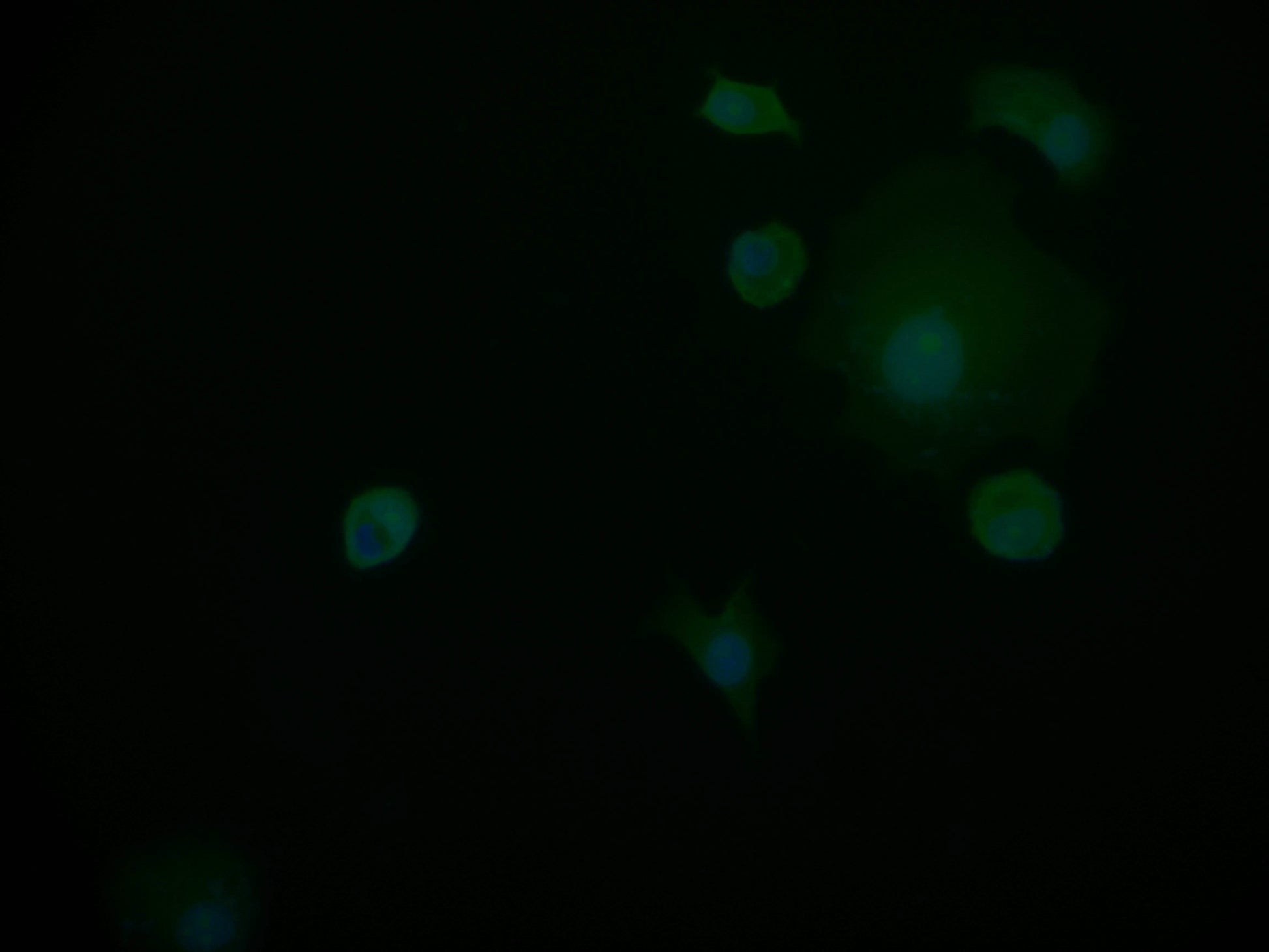 Immunofluorescence staining of MCF-7 cell at 1:50, counter-stained with DAPI. The cells were fixed in 4% formaldehyde and blocked in 10% normal Goat Serum. The cells were then incubated with the antibody overnight at 4Â°C. The secondary antibody was Alexa Fluor 598-congugated AffiniPure Goat Anti-Rabbit IgG(H+L).