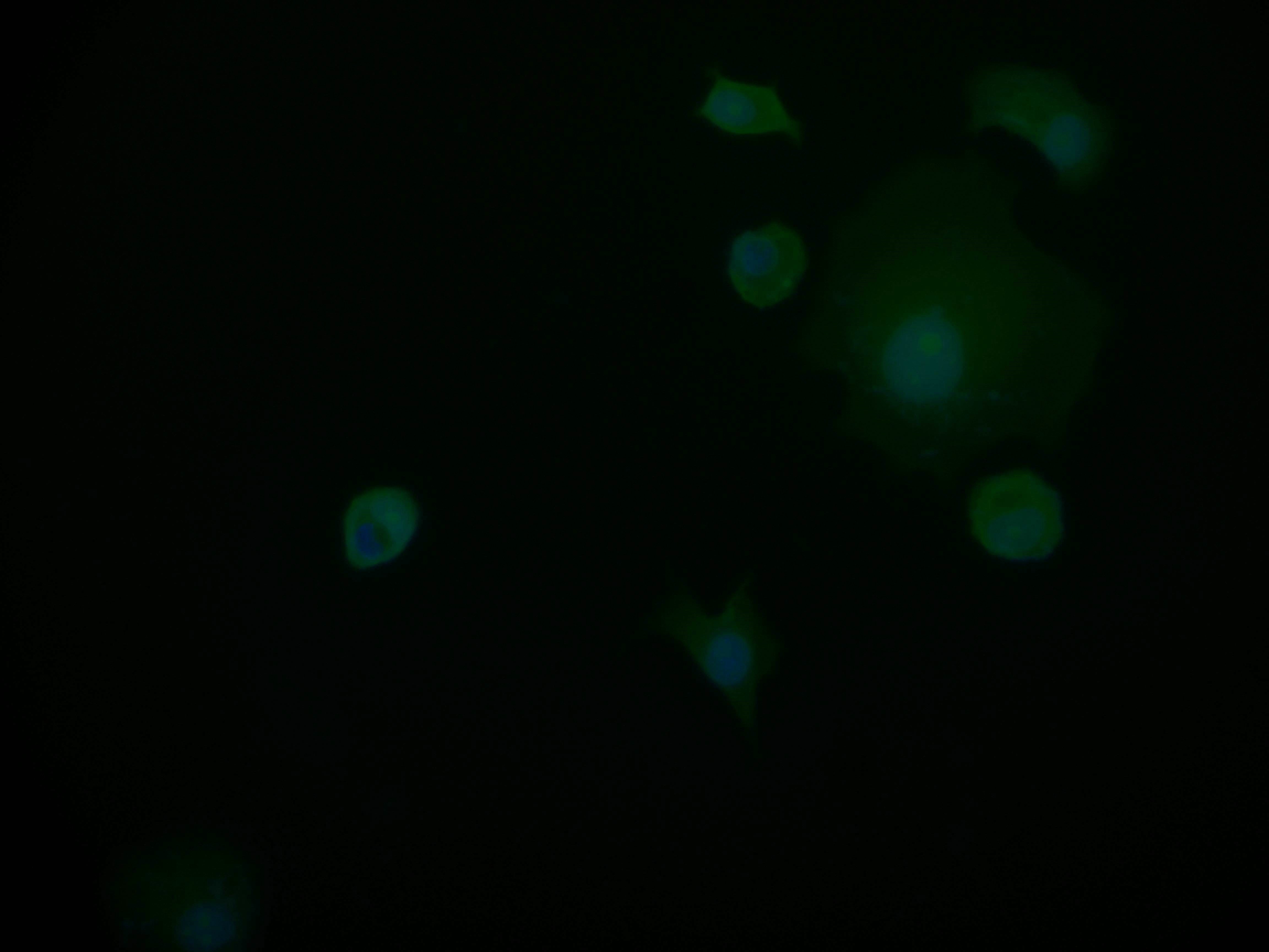 Immunofluorescence staining of MCF-7 cell at 1:50, counter-stained with DAPI. The cells were fixed in 4% formaldehyde and blocked in 10% normal Goat Serum. The cells were then incubated with the antibody overnight at 4Â°C. The secondary antibody was Alexa Fluor 598-congugated AffiniPure Goat Anti-Rabbit IgG(H+L).