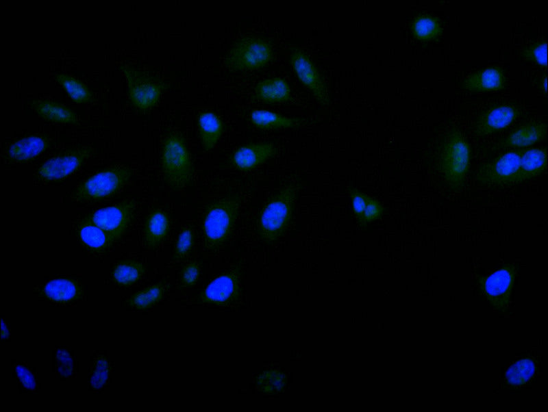 Immunofluorescence staining of A549 with RAC07669 at 1:20, counter-stained with DAPI. The cells were fixed in 4% formaldehyde and blocked in 10% normal Goat Serum. The cells were then incubated with the antibody overnight at 4Â°C. The secondary antibody was Alexa Fluor 520-congugated AffiniPure Goat Anti-Rabbit IgG(H+L).