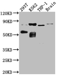 Western Blot; Positive WB detected in: 293T whole cell lysate, K562 whole cell lysate, THP-1 whole cell lysate, Mouse Brain whole cell lysate; All lanes: PKC antibody at 1:1000; Secondary; Goat polyclonal to rabbit IgG at 1/50000 dilution; Predicted band size: 82, 75, 68 kDa; Observed band size: 82, 55 kDa