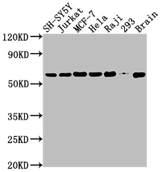 Western Blot; Positive WB detected in: SH-SY5Y whole cell lysate, Jurkat whole cell lysate, MCF-7 whole cell lysate, Hela whole cell lysate, Raji whole cell lysate, 293 whole cell lysate, Mouse brain tissue; All lanes: PKM antibody at 1:2000; Secondary; Goat polyclonal to rabbit IgG at 1/50000 dilution; Predicted band size: 58, 59, 57 kDa; Observed band size: 58 kDa