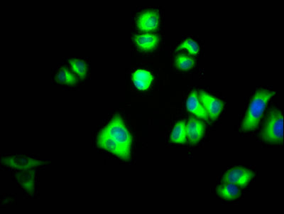Immunofluorescence staining of Hela Cells with RAC07671 at 1:50, counter-stained with DAPI. The cells were fixed in 4% formaldehyde, permeated by 0.2% TritonX-100, and blocked in 10% normal Goat Serum. The cells were then incubated with the antibody overnight at 4?. Nuclear DNA was labeled in blue with DAPI. The secondary antibody was FITC-conjugated AffiniPure Goat Anti-Rabbit IgG (H+L).