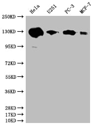 Western Blot; Positive WB detected in: Hela whole cell lysate, U251 whole cell lysate, PC3 whole cell lysate, MCF-7 whole cell lysate; All lanes: PKN2 antibody at 1:2000; Secondary; Goat polyclonal to rabbit IgG at 1/50000 dilution; Predicted band size: 113, 117, 112 kDa; Observed band size: 130 kDa