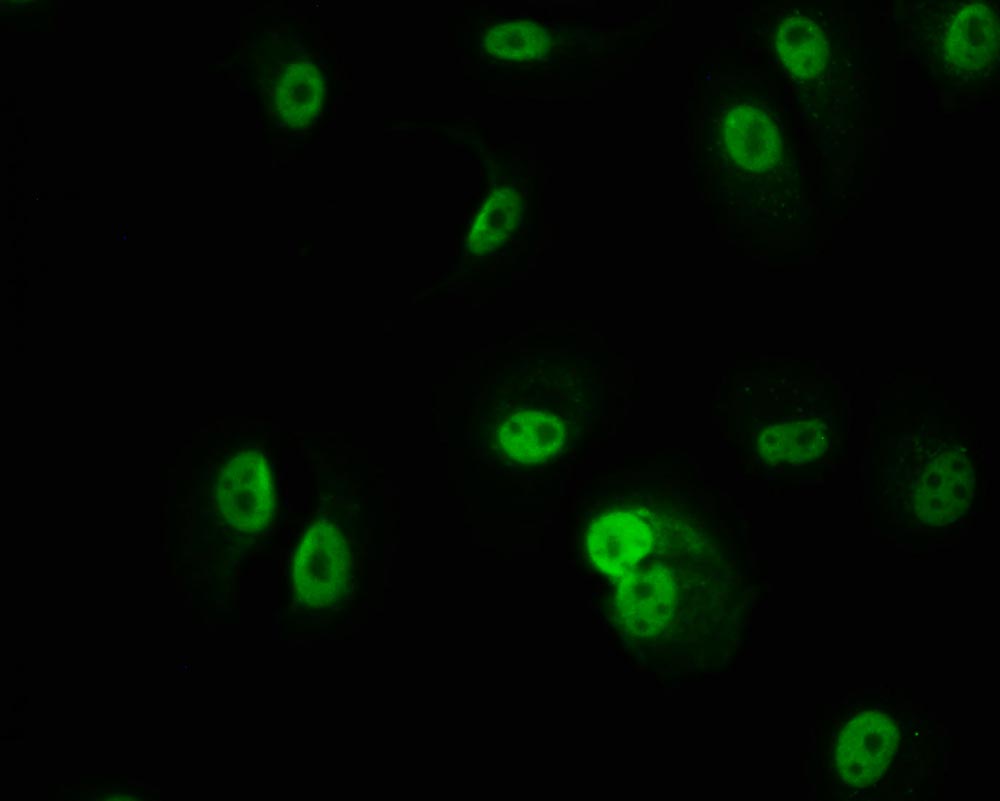 Immunofluorescence staining of MCF-7 cell with RAC07672 at 1:50, counter-stained with DAPI. The cells were fixed in 4% formaldehyde and blocked in 10% normal Goat Serum. The cells were then incubated with the antibody overnight at 4Â°C. The secondary antibody was Alexa Fluor 509-congugated AffiniPure Goat Anti-Rabbit IgG(H+L).