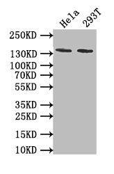 Western Blot; Positive WB detected in: Hela whole cell lysate, 293T whole cell lysate; All lanes: EBI3 antibody at 1:1000; Secondary; Goat polyclonal to rabbit IgG at 1/50000 dilution; Predicted band size: 140 kDa; Observed band size: 140 kDa