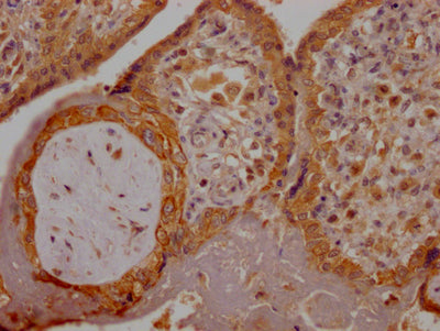 IHC image of RAC07676 diluted at 1:100 and staining in paraffin-embedded human placenta tissue performed on a Leica BondTM system. After dewaxing and hydration, antigen retrieval was mediated by high pressure in a citrate buffer (pH 6.0). Section was blocked with 10% normal goat serum 30min at RT. Then primary antibody (1% BSA) was incubated at 4? overnight. The primary is detected by a Goat anti-rabbit IgG polymer labeled by HRP and visualized using 0.05% DAB.