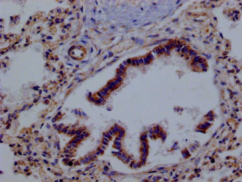 IHC image of RAC07679 diluted at 1:100 and staining in paraffin-embedded human lung tissue performed on a Leica BondTM system. After dewaxing and hydration, antigen retrieval was mediated by high pressure in a citrate buffer (pH 6.0). Section was blocked with 10% normal goat serum 30min at RT. Then primary antibody (1% BSA) was incubated at 4Â°C overnight. The primary is detected by a Goat anti-rabbit polymer IgG labeled by HRP and visualized using 0.05% DAB.