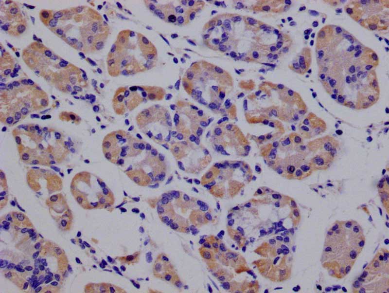 IHC image of RAC07679 diluted at 1:100 and staining in paraffin-embedded human stomach tissue performed on a Leica BondTM system. After dewaxing and hydration, antigen retrieval was mediated by high pressure in a citrate buffer (pH 6.0). Section was blocked with 10% normal goat serum 30min at RT. Then primary antibody (1% BSA) was incubated at 4Â°C overnight. The primary is detected by a Goat anti-rabbit polymer IgG labeled by HRP and visualized using 0.05% DAB.