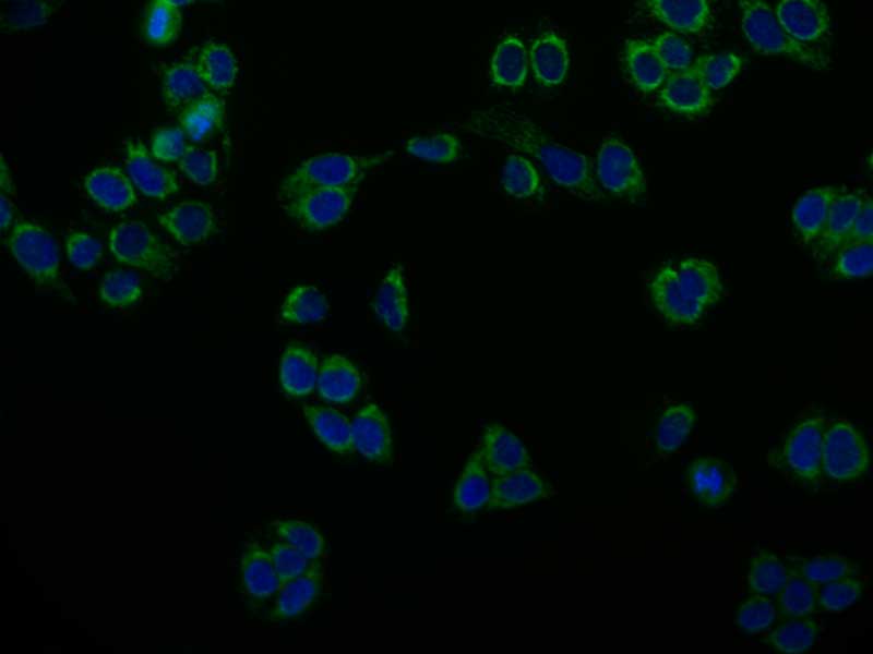 Immunofluorescence staining of PC-3 cell with RAC07679 at 1:50, counter-stained with DAPI. The cells were fixed in 4% formaldehyde and blocked in 10% normal Goat Serum. The cells were then incubated with the antibody overnight at 4Â°C. The secondary antibody was Alexa Fluor 503-congugated AffiniPure Goat Anti-Rabbit IgG(H+L).