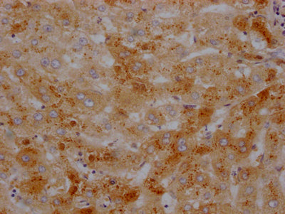 IHC image of RAC07680 diluted at 1:100 and staining in paraffin-embedded human liver tissue performed on a Leica BondTM system. After dewaxing and hydration, antigen retrieval was mediated by high pressure in a citrate buffer (pH 6.0). Section was blocked with 10% normal goat serum 30min at RT. Then primary antibody (1% BSA) was incubated at 4? overnight. The primary is detected by a Goat anti-rabbit IgG polymer labeled by HRP and visualized using 0.05% DAB.