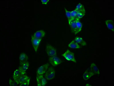 Immunofluorescence staining of Hela cells with RAC07682 at 1:36, counter-stained with DAPI. The cells were fixed in 4% formaldehyde, permeabilized using 0.2% Triton X-100 and blocked in 10% normal Goat Serum. The cells were then incubated with the antibody overnight at 4?. The secondary antibody was Alexa Fluor 488-congugated AffiniPure Goat Anti-Rabbit IgG (H+L).