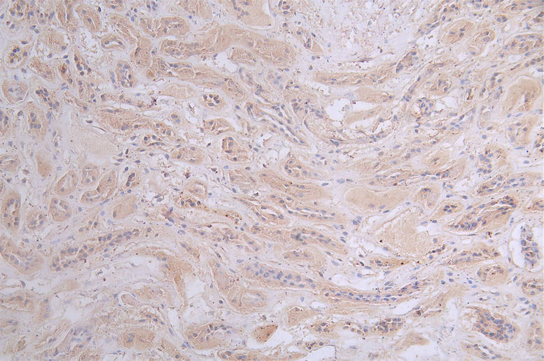 IHC image of RAC07683 diluted at 1:50 and staining in paraffin-embedded human kidney tissue performed on a Leica BondTM system. After dewaxing and hydration, antigen retrieval was mediated by high pressure in a citrate buffer (pH 6.0). Section was blocked with 10% normal goat serum 30min at RT. Then primary antibody (1% BSA) was incubated at 4Â°C overnight. The primary is detected by a Goat anti-rabbit polymer IgG labeled by HRP and visualized using 0.47% DAB.