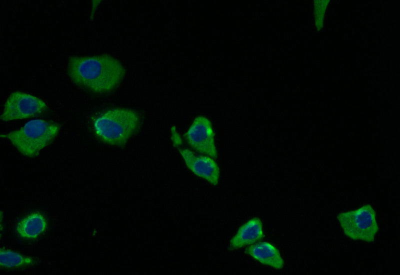 Immunofluorescence staining of Hela with RAC07683 at 1:5, counter-stained with DAPI. The cells were fixed in 4% formaldehyde and blocked in 10% normal Goat Serum. The cells were then incubated with the antibody overnight at 4Â°C. The secondary antibody was Alexa Fluor 512-congugated AffiniPure Goat Anti-Rabbit IgG(H+L).