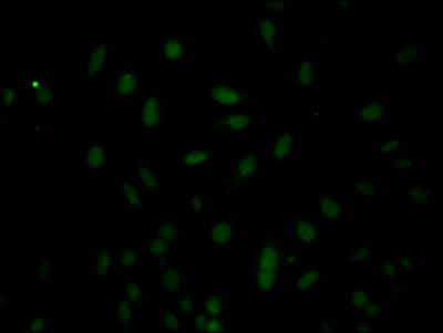 Immunofluorescence staining of Hela Cells with RAC07685 at 1:50, counter-stained with DAPI. The cells were fixed in 4% formaldehyde, permeated by 0.2% TritonX-100, and blocked in 10% normal Goat Serum. The cells were then incubated with the antibody overnight at 4?. Nuclear DNA was labeled in blue with DAPI. The secondary antibody was FITC-conjugated AffiniPure Goat Anti-Rabbit IgG (H+L).