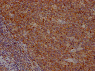 IHC image of RAC07686 diluted at 1:100 and staining in paraffin-embedded human tonsil tissue performed on a Leica BondTM system. After dewaxing and hydration, antigen retrieval was mediated by high pressure in a citrate buffer (pH 6.0). Section was blocked with 10% normal goat serum 30min at RT. Then primary antibody (1% BSA) was incubated at 4? overnight. The primary is detected by a Goat anti-rabbit IgG polymer labeled by HRP and visualized using 0.05% DAB.