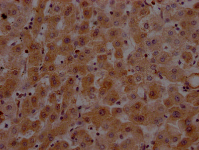 IHC image of RAC07687 diluted at 1:100 and staining in paraffin-embedded human liver tissue performed on a Leica BondTM system. After dewaxing and hydration, antigen retrieval was mediated by high pressure in a citrate buffer (pH 6.0). Section was blocked with 10% normal goat serum 30min at RT. Then primary antibody (1% BSA) was incubated at 4? overnight. The primary is detected by a Goat anti-rabbit IgG polymer labeled by HRP and visualized using 0.05% DAB.