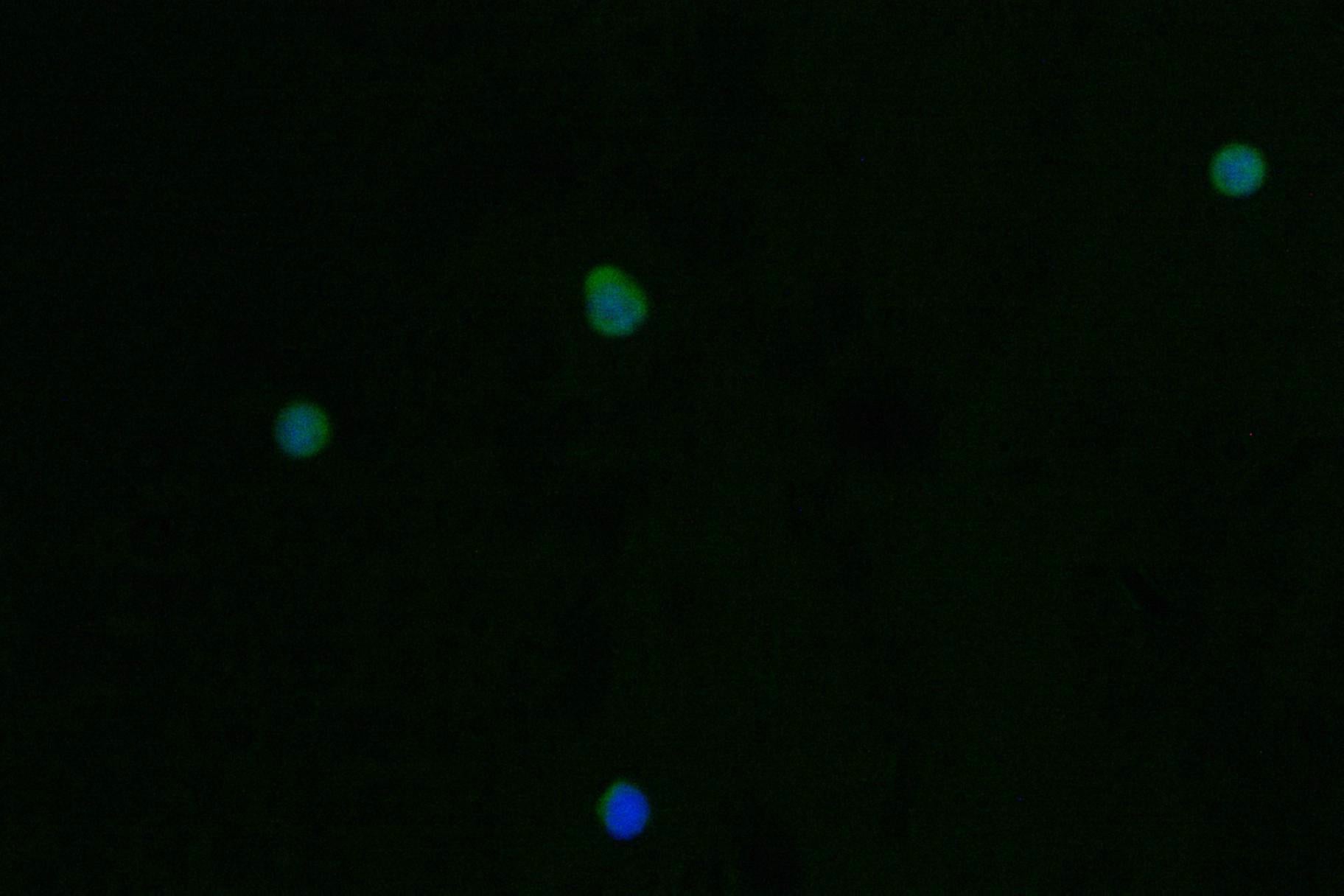 Immunofluorescence staining of Jurkat cell with RAC07688 at 1:50, counter-stained with DAPI. The cells were fixed in 4% formaldehyde and blocked in 10% normal Goat Serum. The cells were then incubated with the antibody overnight at 4Â°C. The secondary antibody was Alexa Fluor 562-congugated AffiniPure Goat Anti-Rabbit IgG(H+L).