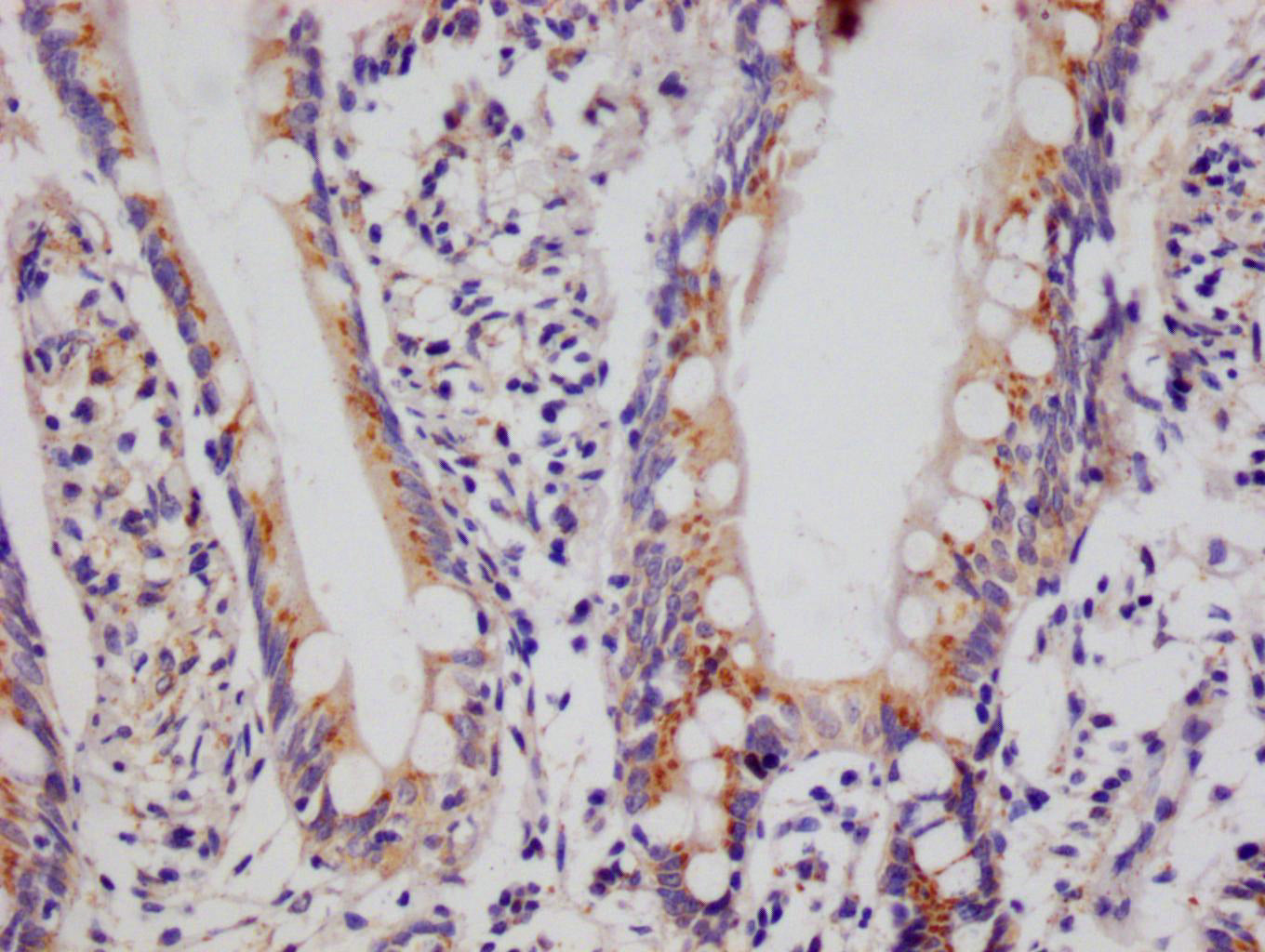 IHC image of RAC07692 diluted at 1:100 and staining in paraffin-embedded human small intestine tissue performed on a Leica BondTM system. After dewaxing and hydration, antigen retrieval was mediated by high pressure in a citrate buffer (pH 6.0). Section was blocked with 10% normal goat serum 30min at RT. Then primary antibody (1% BSA) was incubated at 4Â°C overnight. The primary is detected by a Goat anti-rabbit polymer IgG labeled by HRP and visualized using 0.05% DAB.