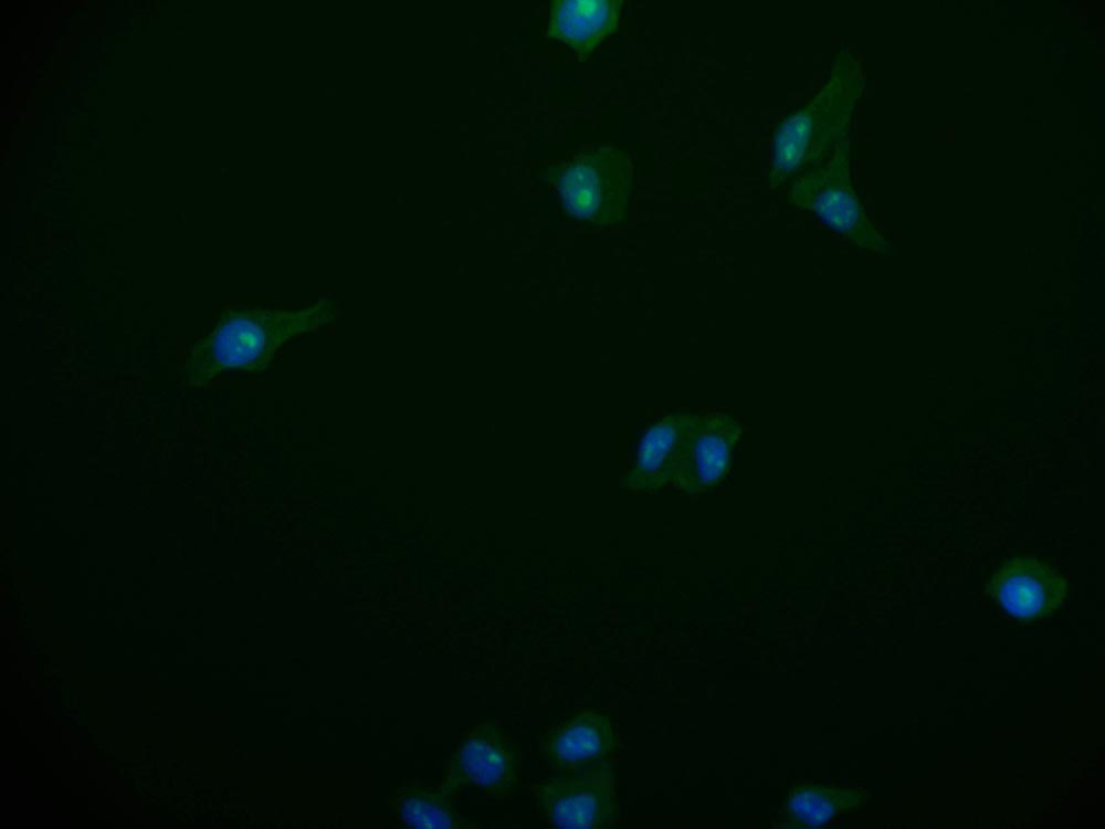 Immunofluorescence staining of HepG2 cell with RAC07692 at 1:50, counter-stained with DAPI. The cells were fixed in 4% formaldehyde and blocked in 10% normal Goat Serum. The cells were then incubated with the antibody overnight at 4Â°C. The secondary antibody was Alexa Fluor 518-congugated AffiniPure Goat Anti-Rabbit IgG(H+L).