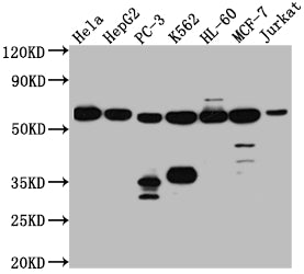 Western Blot; Positive WB detected in: Hela whole cell lysate, HepG2 whole cell lysate, PC-3 whole cell lysate, K562 whole cell lysate, HL-60 whole cell lysate, MCF-7 whole cell lysate, Jurkat whole cell lysate; All lanes: PTBP1 antibody at 1:1000; Secondary; Goat polyclonal to rabbit IgG at 1/50000 dilution; Predicted band size: 58, 60, 60 kDa; Observed band size: 58 kDa