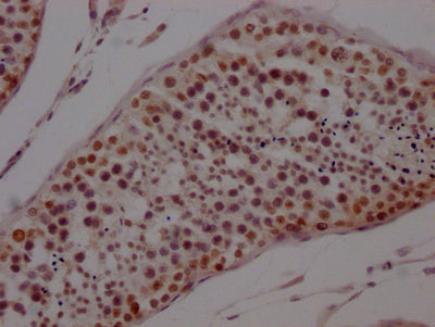 IHC image of RAC07693 diluted at 1:100 and staining in paraffin-embedded human testis tissue performed on a Leica BondTM system. After dewaxing and hydration, antigen retrieval was mediated by high pressure in a citrate buffer (pH 6.0). Section was blocked with 10% normal goat serum 30min at RT. Then primary antibody (1% BSA) was incubated at 4? overnight. The primary is detected by a Goat anti-rabbit IgG polymer labeled by HRP and visualized using 0.05% DAB.