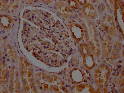 IHC image of RAC07694 diluted at 1:100 and staining in paraffin-embedded human kidney tissue performed on a Leica BondTM system. After dewaxing and hydration, antigen retrieval was mediated by high pressure in a citrate buffer (pH 6.0). Section was blocked with 10% normal goat serum 30min at RT. Then primary antibody (1% BSA) was incubated at 4? overnight. The primary is detected by a Goat anti-rabbit IgG polymer labeled by HRP and visualized using 0.05% DAB.