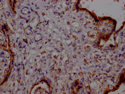 IHC image of RAC07694 diluted at 1:100 and staining in paraffin-embedded human placenta tissue performed on a Leica BondTM system. After dewaxing and hydration, antigen retrieval was mediated by high pressure in a citrate buffer (pH 6.0). Section was blocked with 10% normal goat serum 30min at RT. Then primary antibody (1% BSA) was incubated at 4? overnight. The primary is detected by a Goat anti-rabbit IgG polymer labeled by HRP and visualized using 0.05% DAB.