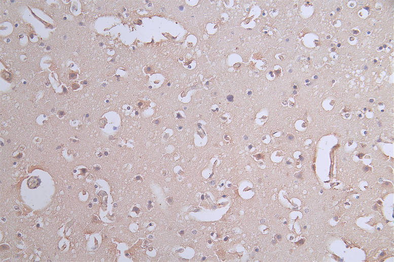 IHC image of RAC07700 diluted at 1:50 and staining in paraffin-embedded human brain tissue performed on a Leica BondTM system. After dewaxing and hydration, antigen retrieval was mediated by high pressure in a citrate buffer (pH 6.0). Section was blocked with 10% normal goat serum 30min at RT. Then primary antibody (1% BSA) was incubated at 4Â°C overnight. The primary is detected by a Goat anti-rabbit polymer IgG labeled by HRP and visualized using 0.62% DAB.