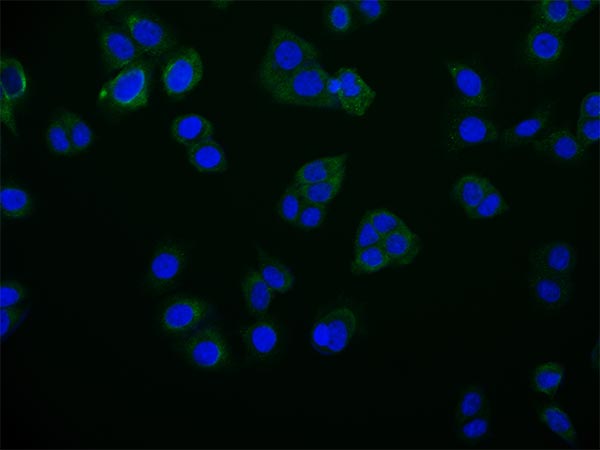 Immunofluorescence staining of PC-3 cell with RAC07701 at 1:50, counter-stained with DAPI. The cells were fixed in 4% formaldehyde and blocked in 10% normal Goat Serum. The cells were then incubated with the antibody overnight at 4Â°C. The secondary antibody was Alexa Fluor 516-congugated AffiniPure Goat Anti-Rabbit IgG(H+L).