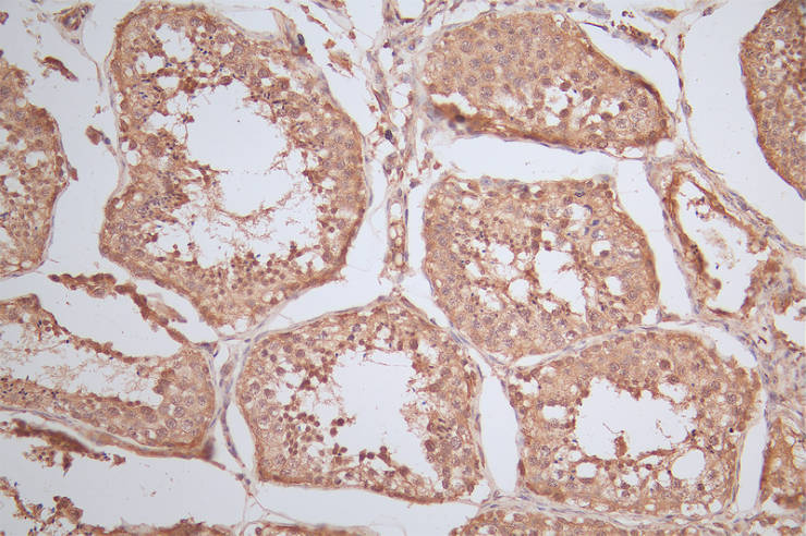 IHC image of RAC07703 diluted at 1:100 and staining in paraffin-embedded human testis tissue performed on a Leica BondTM system. After dewaxing and hydration, antigen retrieval was mediated by high pressure in a citrate buffer (pH 6.0). Section was blocked with 10% normal goat serum 30min at RT. Then primary antibody (1% BSA) was incubated at 4Â°C overnight. The primary is detected by a Goat anti-rabbit polymer IgG labeled by HRP and visualized using 0.78% DAB.