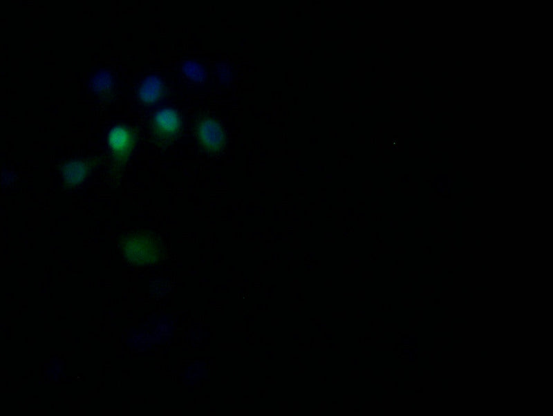 Immunofluorescence staining of Hela with RAC07703 at 1:30, counter-stained with DAPI. The cells were fixed in 4% formaldehyde and blocked in 10% normal Goat Serum. The cells were then incubated with the antibody overnight at 4Â°C. The secondary antibody was Alexa Fluor 527-congugated AffiniPure Goat Anti-Rabbit IgG(H+L).